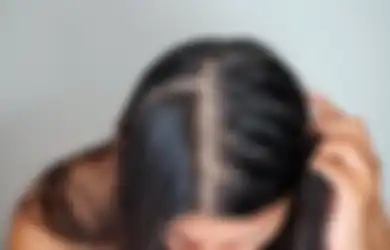 Enggak Boleh Kebanyakan, 5 Makanan Ini Bisa Bikin Rambut Makin Tipis