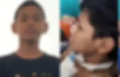 UPDATE Kondisi David Setelah 27 Hari Dirawat, Belum Kenali Ayahnya Tapi Sudah Tunjukkan Perkembangan Ini