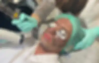Pudarkan Melasma Sampai Tatto Pakai Hollywood Spectra untuk Menolak Tua