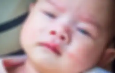 Orangtua Wajib Tahu! Begini Cara Mengatasi Biang Keringat pada Bayi, Dijamin Bruntusan dan Gatal Langsung Lenyap