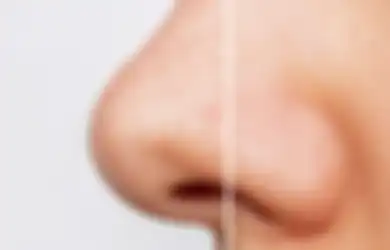 Jangan Dipencet! Gini 4 Cara Menghilangkan Komedo Hitam di Hidung