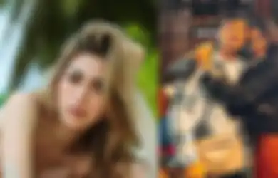 Bela Jessica Iskandar yang Dihujat Gegara Oplas di Korea Padahal Ngaku Bangkrut, Ipar Vincent Verhaag: Itu Hak Setiap Orang