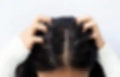 Termasuk Hindari Stres! Berikut 5 Cara Mengatasi Rambut Rontok dan Berketombe