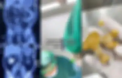 2 Tahun Nyeri Pinggang Tak Sembuh-sembuh, Wanita Ini Ternyata Simpan Benda Mengerikan Sebesar Jahe di dalam Tubuhnya, Kebiasaan Sepele Jadi Gara-garanya