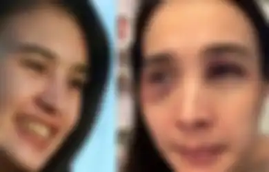 Penyidik Sampai Nangis, Putri Balqis Ditahan Pasca Bela Diri Saat Alami KDRT, Suaminya Malah Kepergok Liburan: Izinnya Operasi