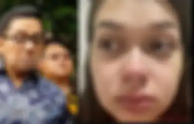 Kondisi Terbaru Rebecca Klopper Diungkap Kuasa Hukum, Sandy Arifin Sebut Kekasih Fadly Faisal Masih Drop Usai Terseret Kasus Video Syur