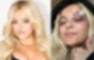 Bebe Rexha Pakai Kacamata di Konser Terbaru Setelah Insiden Dilempar HP Penggemar Sampai Bikin Luka