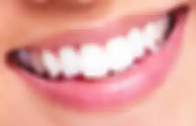 Rekomendasi 4 Whitening Strip yang Ampuh Memutihkan Gigi, Simak