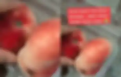Video Wanita Hampir Kehilangan Nyawa Setelah Makan Donat Buah Peach Viral di TikTok, Dilarikan ke UGD Setelah Alami Hal Ini