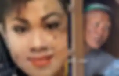 Ratusan Kali Dibawa Berobat Medis hingga ke Dukun Gak Mempan, Begini Nasib Neneng Savitrie, Pedangdut Era 90-an yang Diduga Kena Ilmu Hitam