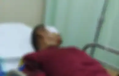 Bola Mata Hancur & Terancam Buta, Guru Penjas Diketapel Wali Murid yang Tak Terima Anak Ditegur saat Merokok di Sekolah