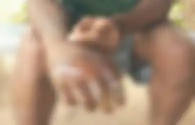 Viral Oknum Guru SMK di Flores Timur Siksa Siswa Pakai Air Panas sampai Tangan Melepuh, Tuduh Korban Curi Kopi Sachet