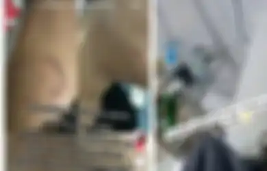 Viral di TikTok, Wanita Ini Curhat Digigit sampai Infeksi oleh Selingkuhan Suaminya, Sikap Sang Mertua Bikin Tepok Jidat