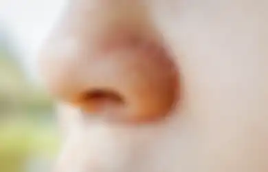 8 Cara Hilangkan Kulit Kering dan Bersisik di Area Hidung, Pasti Ampuh