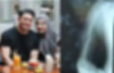 Innalillahi, Terbaring di Ranjang Rumah Sakit, Irwansyah Alami Patah Tulang Saat Berkuda