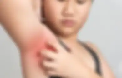 Tak Sangka, 10 Hal Ini Bisa Menyebabkan Ruam Diketiak, Perhatikan