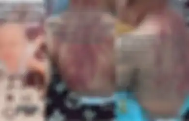 Viral di TikTok Bayi 13 Bulan Dikerokin Sampai Kulit Merah oleh Pengasuh, sang Ibu Syok hingga Pilih Lakukan Ini