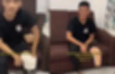 Usia Baru 21 Tahun, Pemuda Ini Rela Satu Kakinya Diamputasi, Nyesel dengan Kebiasaannya Ini