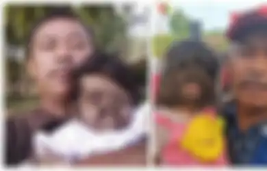 Alami Kondisi Fisik Werewolf Syndrome Sejak Lahir, Seluruh Tubuh Gadis Kecil Ini Ditumbuhi Bulu Lebat