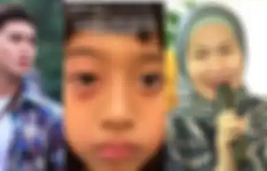 Verrel Bramasta Bagikan Kondisi Vania Athabina yang Jadi Korban Bullying di Sekolah: Mata Bengkak