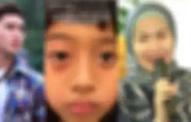Vania Dibully di Sekolah, Verrell Bramasta Murka Adiknya Dilempari Batu, Kondisi Mata Bikin Sedih: Siapa yang Berani?