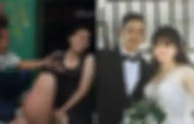 Viral Kecantikan Pengantin Wanita Tak Luntur Meski Derita Kaki Gajah, Pernikahannya Jadi Sorotan