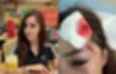Innalillahi, Selebgram Safa Marwah Dianiaya Pacar, Mukanya Bersimbah Darah Dipukuli saat Tagih Utang Rp 42 Juta: Ini Paling Parah
