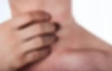 5 Cara Jitu Mengatasi Biang Keringat yang Menganggu karena Cuaca Panas