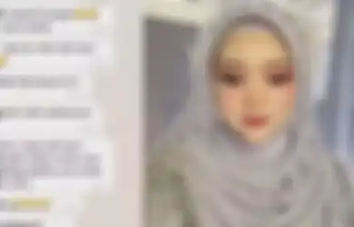 Kecelakaan H-3 Pernikahan, Wajah Penuh Luka Manten Wanita Berhasil Disulap Cantik Jelita Oleh sang MUA