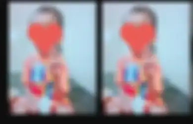 Bocah Cilik di Malang Pilu Dianiaya Keluarga Sendiri, Motif Pelaku Sepele, Kondisi Korban Memprihatinkan