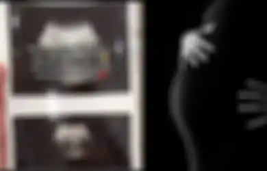 Viral Kisah Ibu Hamil Kehilangan Janin dalam Kandungan usai Tolong Nenek-nenek saat Magrib, Warganet Singgung Sosok Hantu Palasik