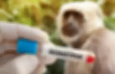 Pakai Kondom Saat Hubungan Intim Ternyata Tetap Bisa Terular Cacar Monyet, Ini Penjelasan Dokter