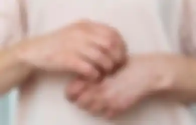 Meski Sudah Pakai Kondom, Penularan Cacar Monyet Ternyata Masih Bisa Terjadi saat Hubungan Intim