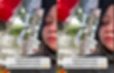SEDIH! Wanita Curhat Ditolak HRD Lantaran Wajah Jerawatan hingga Jadi Korban Body Shaming, Kisahnya Viral di TikTok