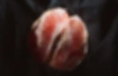 Berkisar dari Merah Muda hingga Cokelat Tua, Warna Vagina Hitam Apakah Normal?