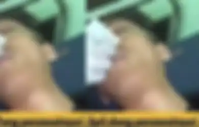 Viral Perawat Cewek Cengengesan saat Urus Pasien Korban Kecelakaan, Kepala Puskesmas Minta Maaf: Kami Berikan Sanksi