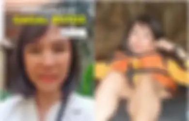 Kehidupan Wanita Gagal Botox, Curhatannya Viral di TikTok, Wajahnya Jadi Begini dan Tak Bisa Berekspresi