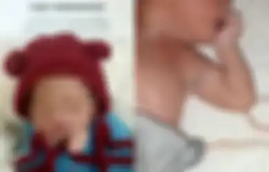 Terbongkar Aksi Ngawur Klinik Alifa Tasikmalaya Lainnya, Bayi Baru Lahir Belum Potong Tali Pusar Malah Dibuat Begini