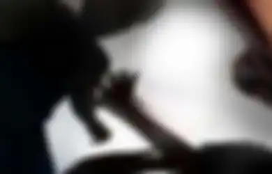 Suami di Kuningan Bacok Istri hingga 1 Jari Nyaris Putus, Pelaku Juga Diduga Lecehkan Anak
