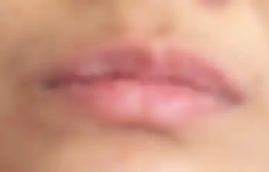 Sering Mencabut Kulit Bibir yang Kering? Awas 4 Bahaya Ini Mengintai!