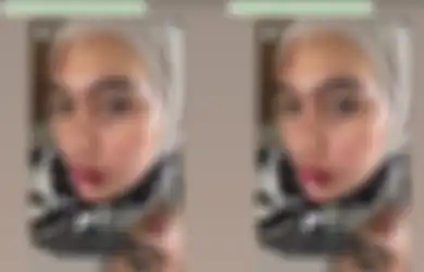 Mulut Melepuh, Kartika Putri Sindir Oknum yang Jadikan Penyakitnya Bahan Pansos, Istri Habib Usman Singgung Dosa