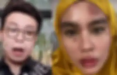 Sindir Kartika Putri yang Berobat ke Singapura, Richard Lee Tawari Istri Habib Usman Datang ke Kliniknya: Bisa Sekalian Podcast