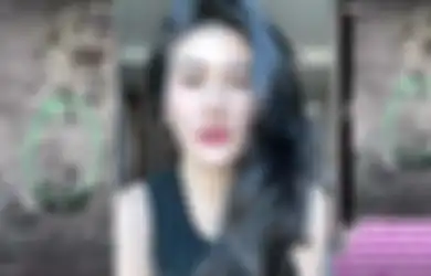 Benda Aneh Sepanjang 10 Cm Bersarang di Pinggul Stevie Agnecya, Dokter Buka Suara Soal Hasil Rontgen Mantan Istri Samuel Rizal