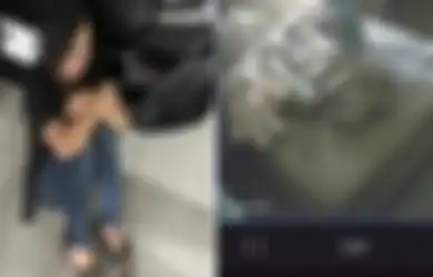 Sudah Jelas Babak Belur, Anak Aghnia Punjabi Disebut Diserang Hewan oleh Suster yang Menghajarnya, Pelaku Sempat Kata-katai Majikannya