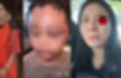 Tak Masuk Akal! Ternyata Ini Motif IPS Tega Siksa Anak Aghnia Punjabi 1 Jam Non Stop