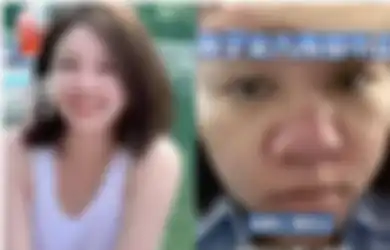 Dulu Ramping dan Berkulit Mulus, Mama Muda Stres Penampilan Berubah Sejak Mengandung, Hidung Ikut Melendung