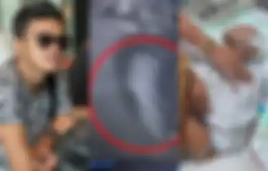 Konten Kreator Polri Kritis Pendarahan Otak Usai Diseret Begal 150 Meter, Begini Kronologinya