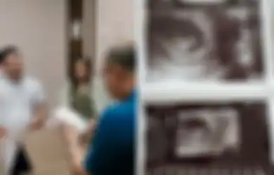 Jessica Iskandar Jalani Program Bayi Tabung,  Harap Anak Ketiganya Punya Shio Naga