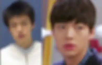 Enggak Hanya Cewek! 5 Seleb Cowok Korea Ini Juga Jadi Lebih Cakep & Sukses Setelah Operasi Plastik