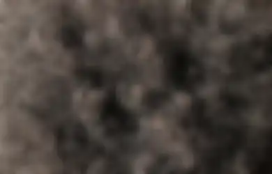 4 Bahan Alami Ini Bisa Atasi Masalah Rambut Rontok, Meski Bau Ternyata Bawang Putih Juga Bisa Loh